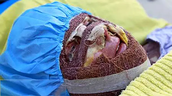 زنده زنده سوختن 51 زن و مرد اصفهانی / تجربه مرگ های تلخ در 90 روز 