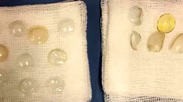 27 لنز زیبایی از چشمان یک زن خارج شد