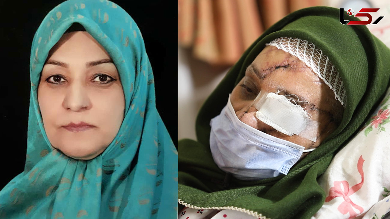ترسناکترین سرنوشت یک زن ایرانی / اشرف سادات حسینی تکه تکه شد اما زنده ماند + عکس و فیلم 16+