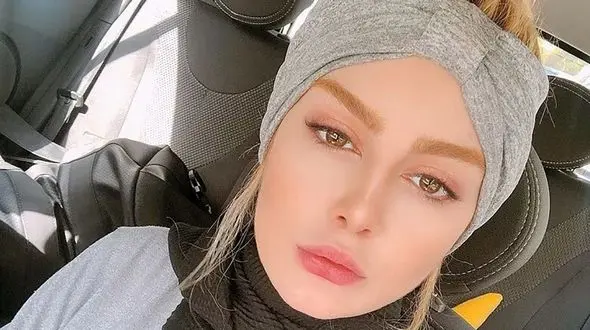 تتوی صورت سحر قریشی چه شد ؟ + عکس تغییر چهره شوکه کننده خانم بازیگر !
