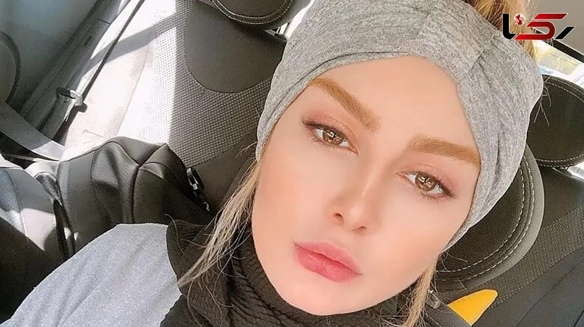 تتوی صورت سحر قریشی چه شد ؟ + عکس تغییر چهره شوکه کننده خانم بازیگر !