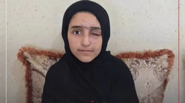 عکس/ در چشم‌های او جنگ باقی ماند / ترکش هایی که از چشم معصومه دختر هرمزگانی خارج شدند