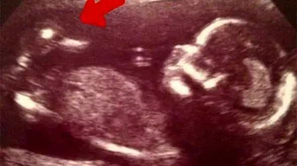 این زن یک اردک را باردار است+عکس