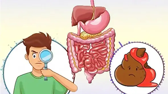 بررسی علل وجود خون در مدفوع / از تشخیص تا درمان