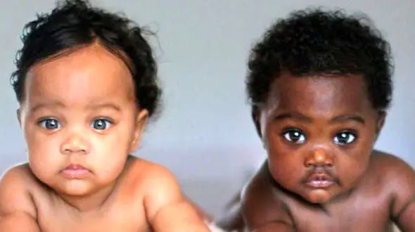 دوقلوهایی عجیب که در فضای مجازی غوغا به پا کردند+عکس 