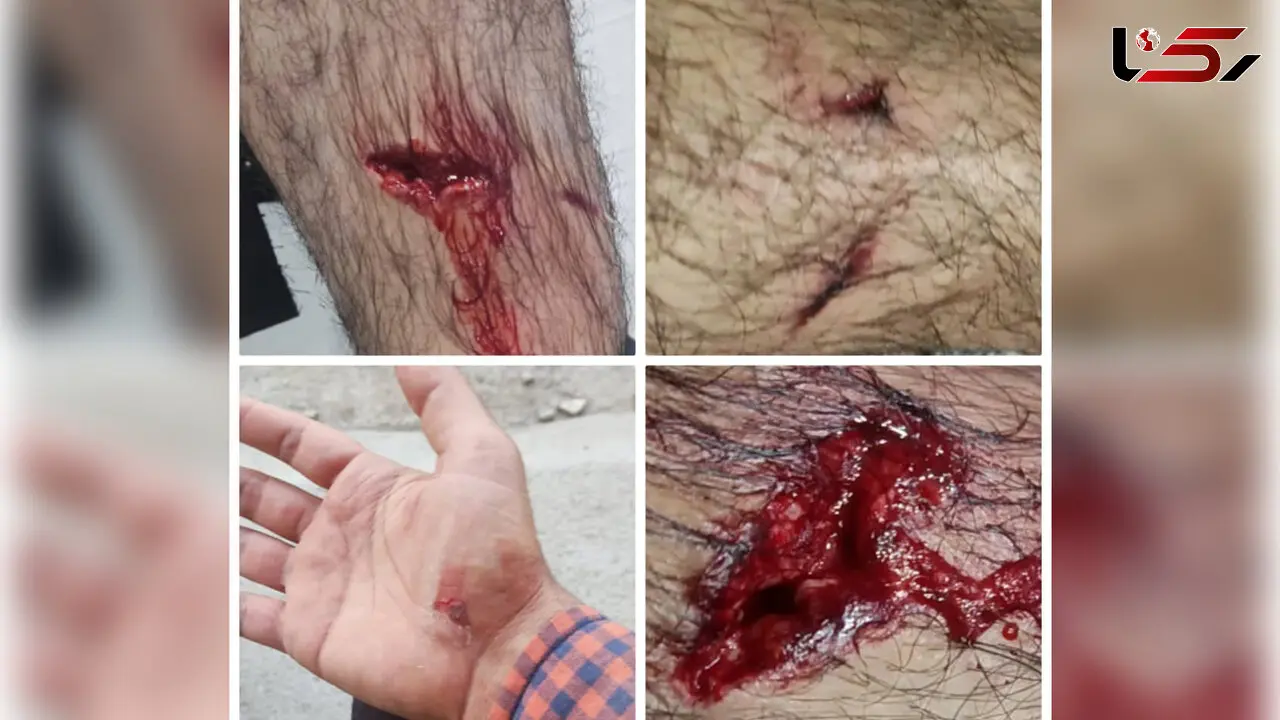 حمله خونین سگ ولگرد به خبرنگار صدا و سیمای آبادان + عکس