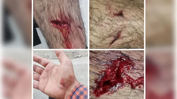 حمله خونین سگ ولگرد به خبرنگار صدا و سیمای آبادان + عکس
