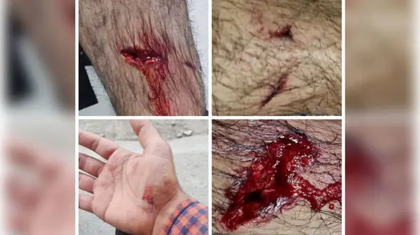 حمله خونین سگ ولگرد به خبرنگار صدا و سیمای آبادان + عکس