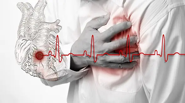 سن سکته قلبی در ایران به ۳۵ سال رسید ! / مرگ سالانه ۱۶۰ هزار ایرانی بر اثر بیماری قلبی 