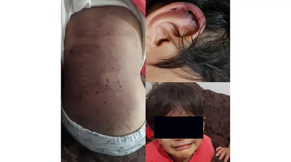 کودک آزارى در ارومیه توسط نامادر بى رحم+ عکس تکاندهنده