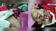 اولین عکس های دلخراش از زن پیرانشهری که هدف حمله خرس وحشی شد 