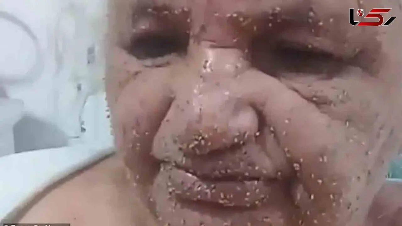 حمله وحشتناک زنبورها به 2 زن +عکس