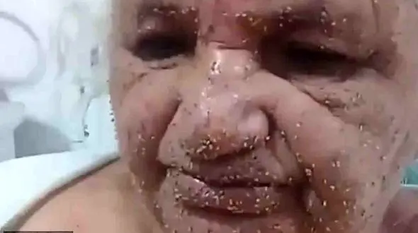 حمله وحشتناک زنبورها به 2 زن +عکس