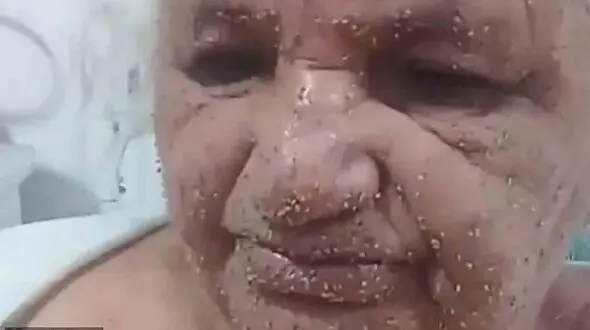 حمله وحشتناک زنبورها به 2 زن +عکس