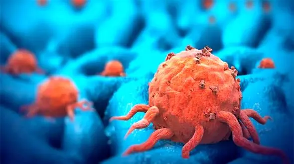 پاشنه آشیل مرگبارترین سرطان پوست کشف شد!