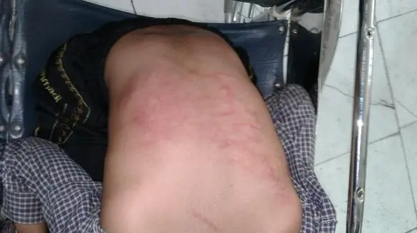 شکنجه های پسر 11 ساله در خانه  شیشه ای  + عکس دلخراش 