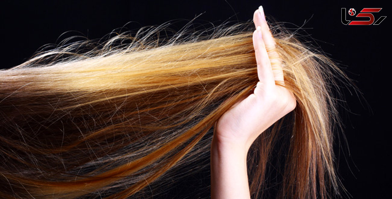 مشکلات مو نشان دهنده  چه بیماری هایی است؟