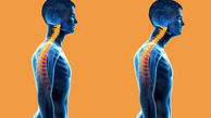 حرکات اصلاحی گردن رو به جلو