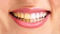 عواملی که سبب تیرگی رنگ دندان ها می شوند!