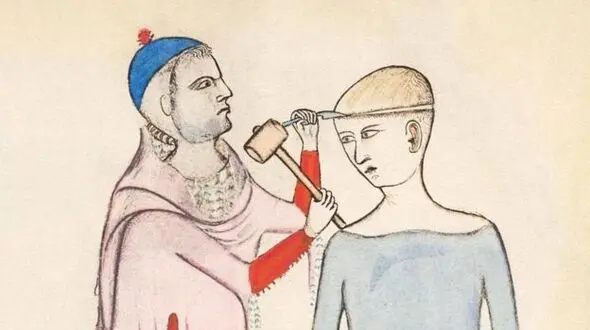 چرا اجداد ما جمجمه همدیگر را سوراخ می‌کردند