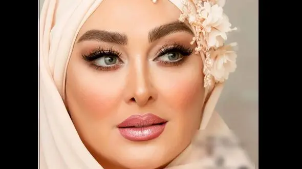 تغییر چهره الهام حمیدی قبل از عمل زیبایی / خانم بازیگر چه بود و چه شد + عکس