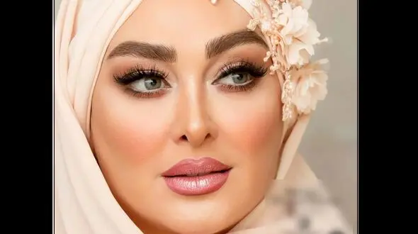تغییر چهره الهام حمیدی قبل از عمل زیبایی / خانم بازیگر چه بود و چه شد + عکس