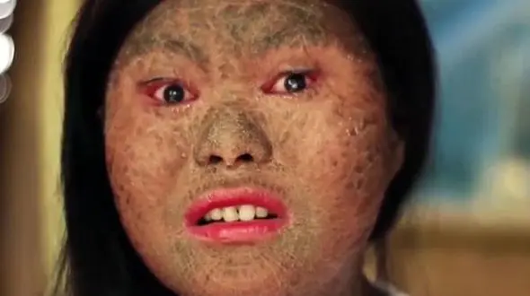 بانوی مار به دنبال راهکاری برای درمان+تصویر