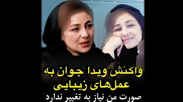 ویدا جوان: صورت من نیازی به عمل های زیبایی ندارد / مردم باعث می شوند هنرمندان عمل کنند !