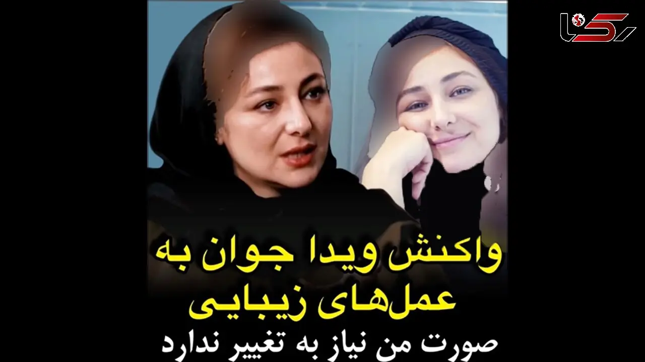 ویدا جوان: صورت من نیازی به عمل های زیبایی ندارد / مردم باعث می شوند هنرمندان عمل کنند !