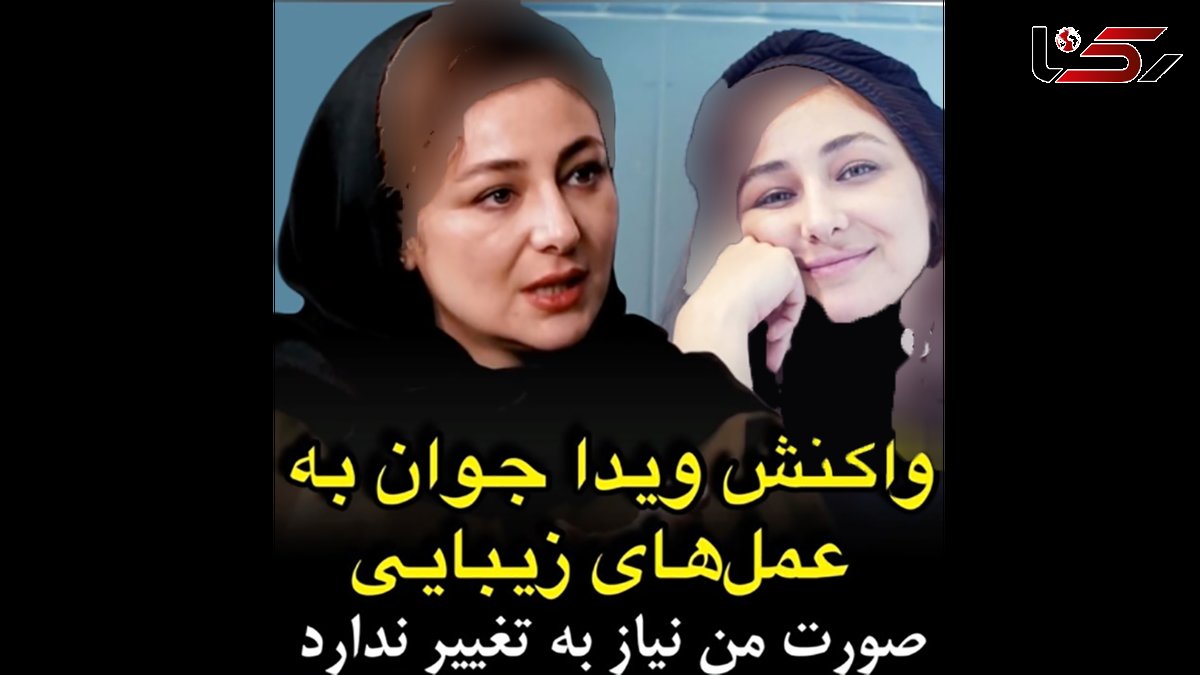 ویدا جوان: صورت من نیازی به عمل های زیبایی ندارد / مردم باعث می شوند هنرمندان عمل کنند !