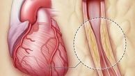 بهترین خوراکی ها برای باز شدن رگ های قلب / عوامل بسته شدن رگ قلب