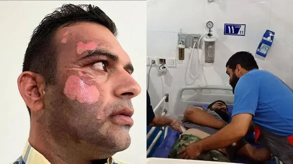 عاملان ضرب و شتم یگان حفاظت طبیعی دستگیر شد / آنها صورت محیط بان را سوزانده بودند + عکس و جزئیات