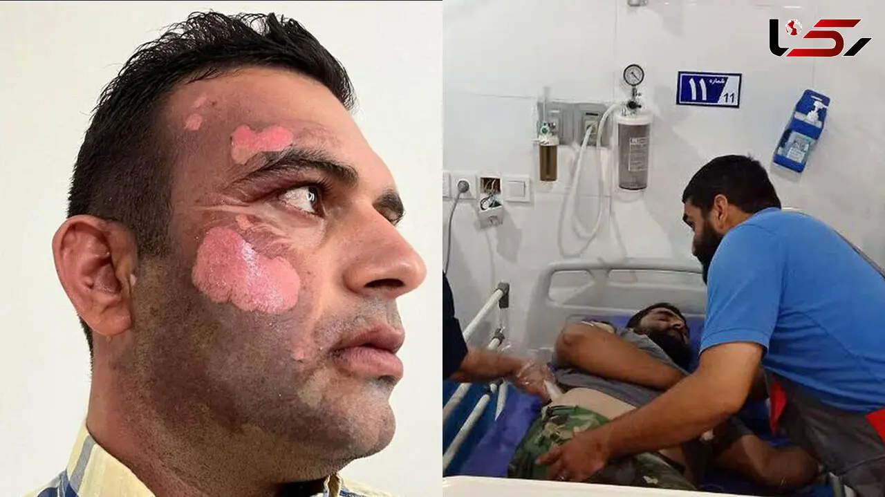 عاملان ضرب و شتم یگان حفاظت طبیعی دستگیر شد / آنها صورت محیط بان را سوزانده بودند + عکس و جزئیات