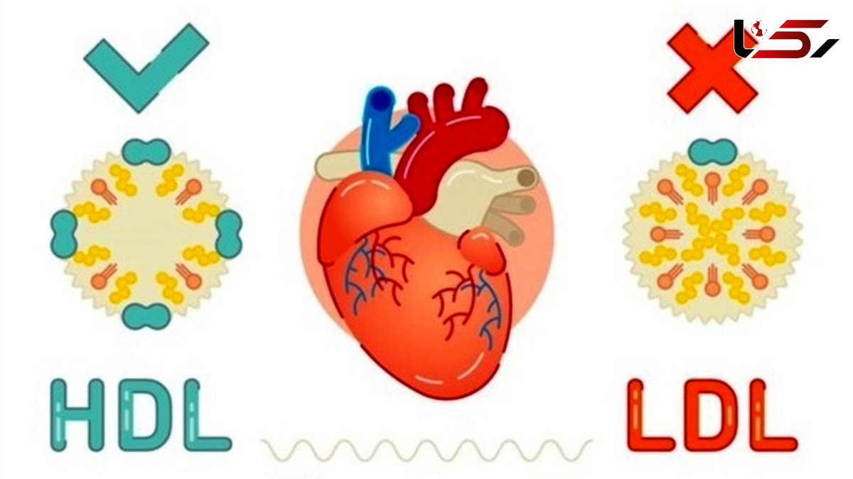 بهترین روش کاهش سطح کلسترول بد خون