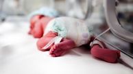 ارتباط مصرف ریتالین و تولد نوزادان با نواقص قلبی