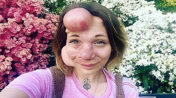 عکس عجیب الخلقه ترین دختر بعد از عمل های عروسکی / چی بود و چی شد!