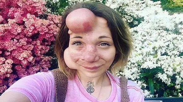 عکس عجیب الخلقه ترین دختر بعد از عمل های عروسکی / چی بود و چی شد!