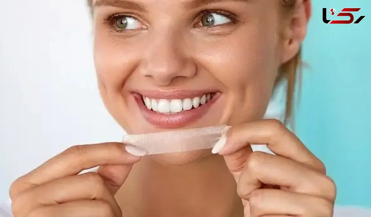 بلیچینگ دندان؛ از حساسیت و آسیب مینا تا فریب تبلیغات لیزر و LED