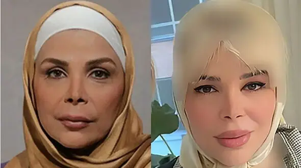 این زن همین زن است باور می کنید؟ / چهره جوان شده خانم بازیگر پیر !