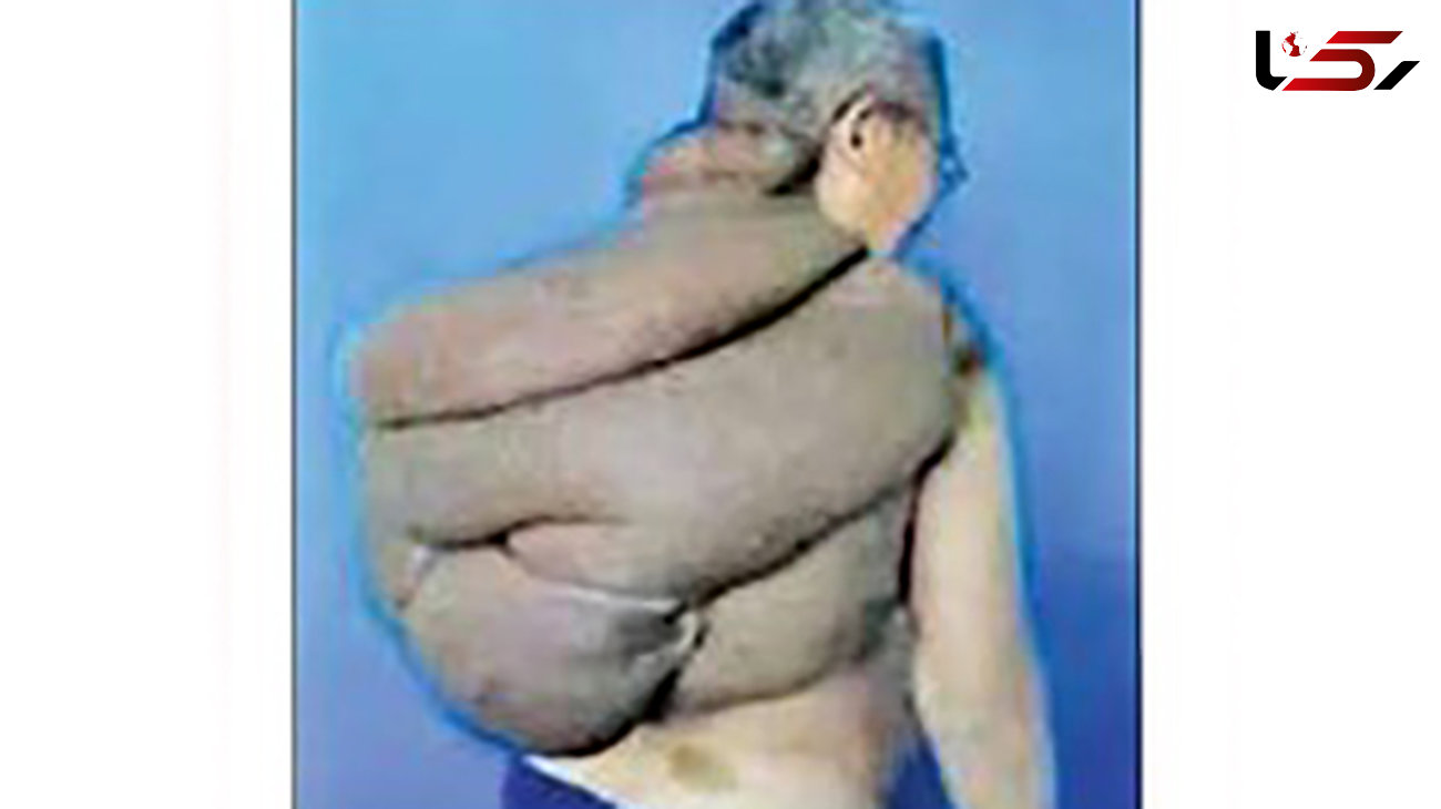 مرد لاک پشتی / این لاک 15 کیلو وزن دارد +  عکس