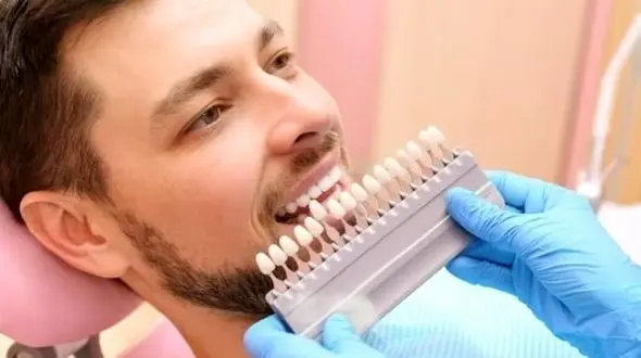 آیا لمینت های دندانی عوارض دارند؟