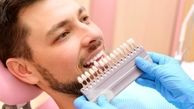 آیا لمینت های دندانی عوارض دارند؟