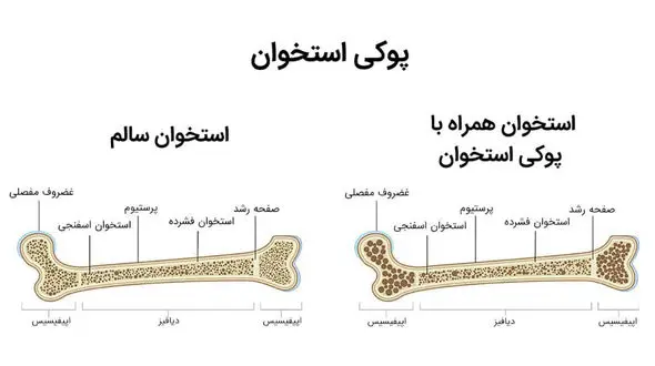 معجون تقویت استخوان 