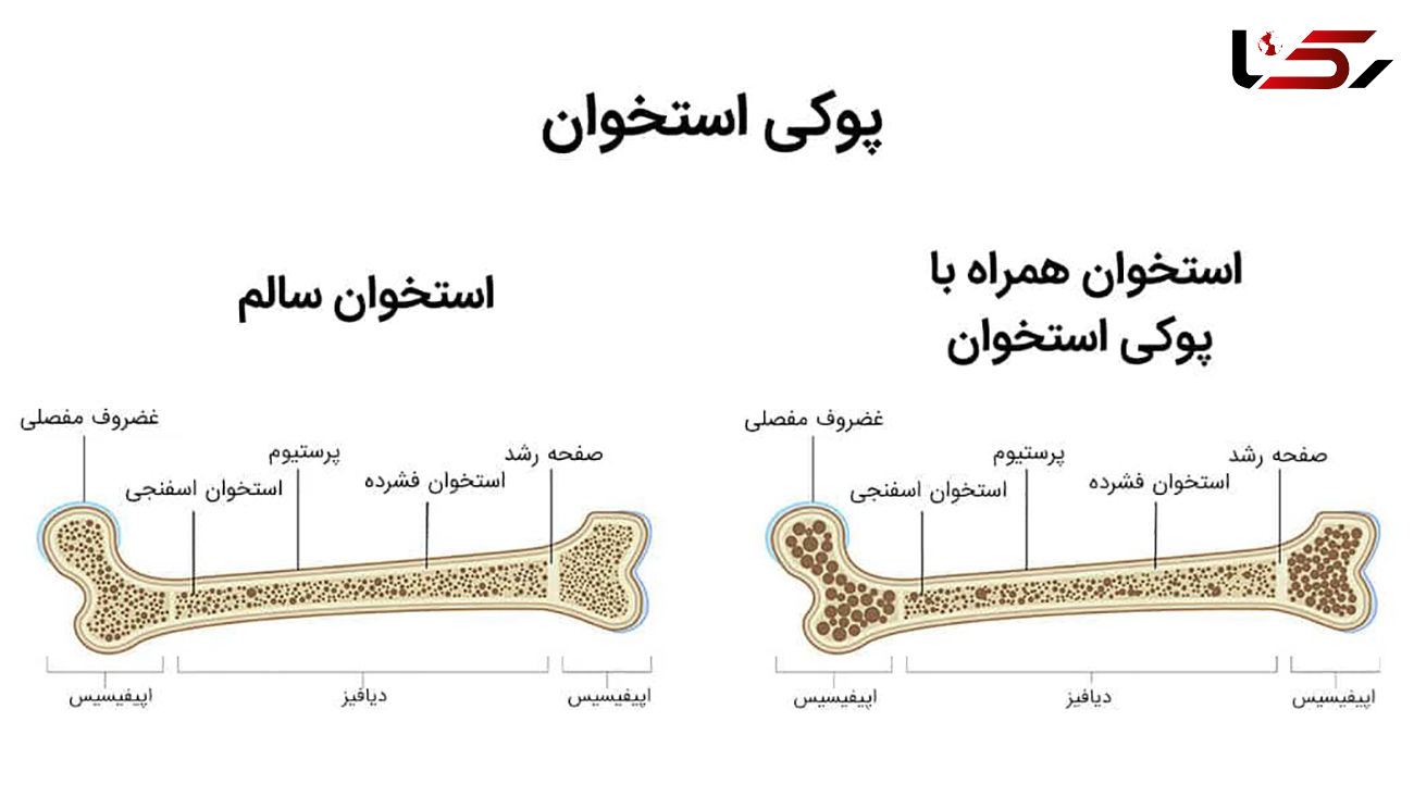 معجون تقویت استخوان 