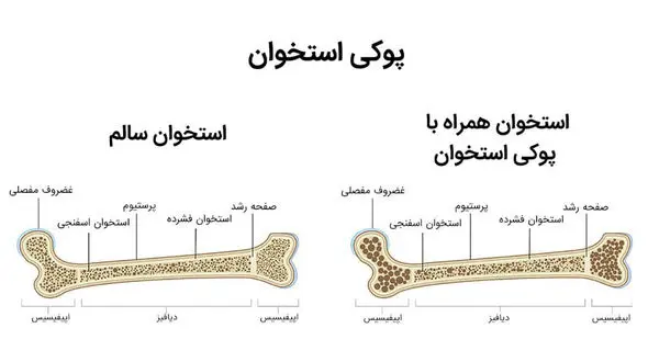 معجون تقویت استخوان 