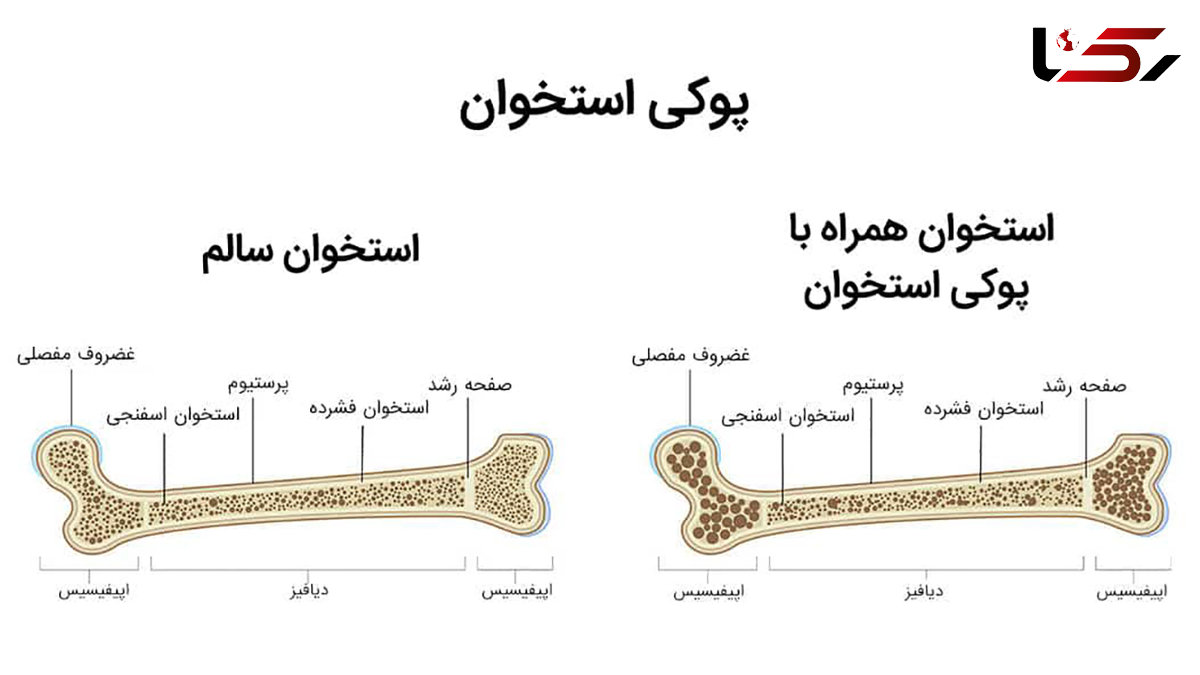 معجون تقویت استخوان 