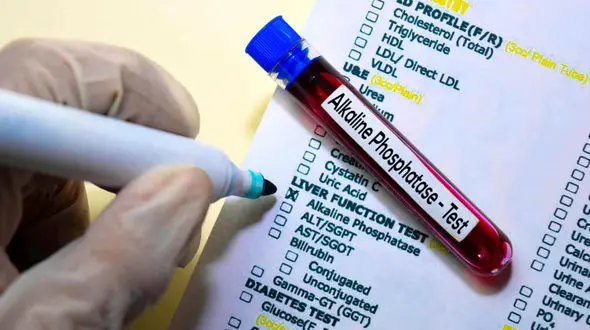 sgpt alt در آزمایش خون چیست ؟ + فیلم