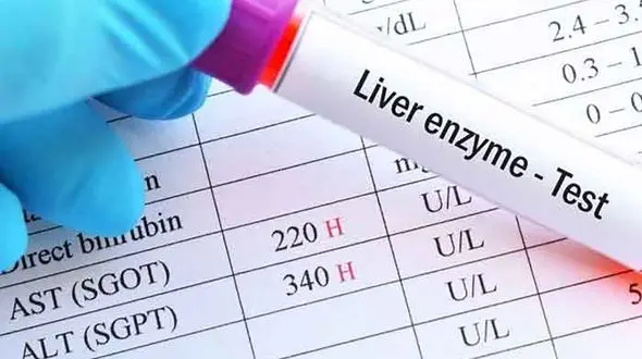 a.s.t در آزمایش خون چیست؟ / جدول شرایط احتمالی کبد براساس افزایش مقادیر آ اس تی