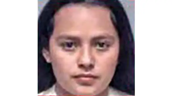  نامادری صورت بچه را آتش زد