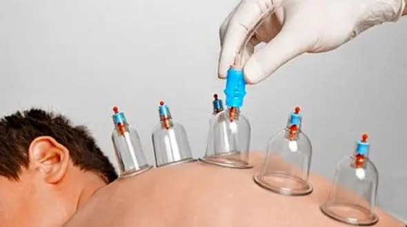 چه افرادی نباید حجامت کنند؟